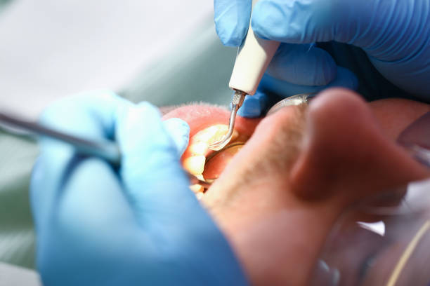 Best Root Canal Emergency Dentist  in Pulaski, WI