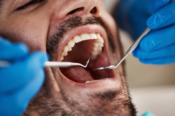 Best Cracked Tooth Emergency Dentist  in Pulaski, WI
